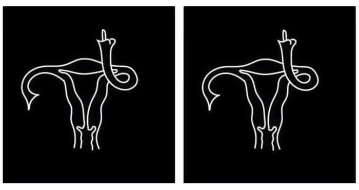 ovaries.jpg