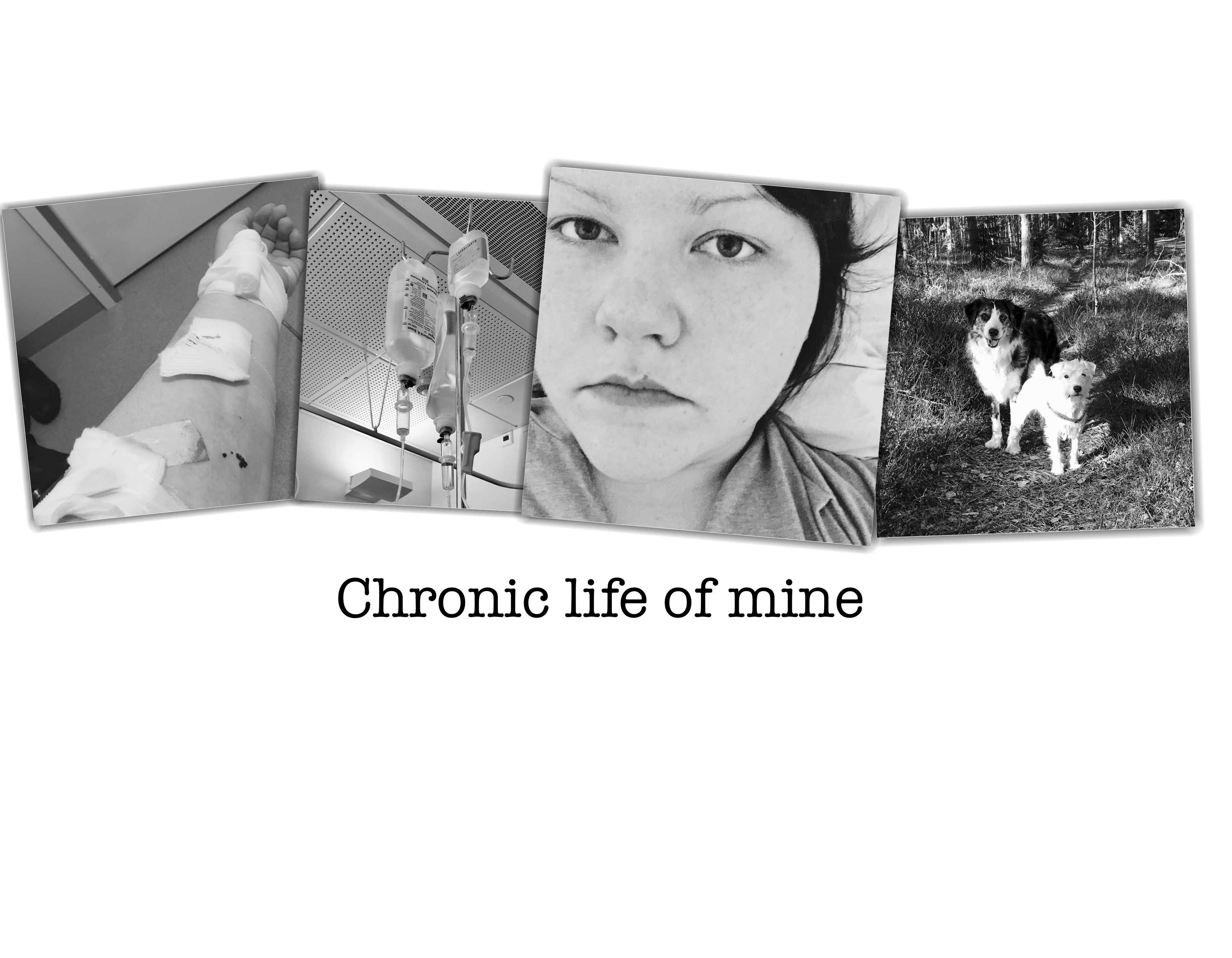 Neuromodulaatiohoito Chronic Life Of Mine Lily