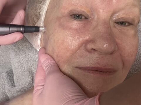 Dermatude metaterapia
